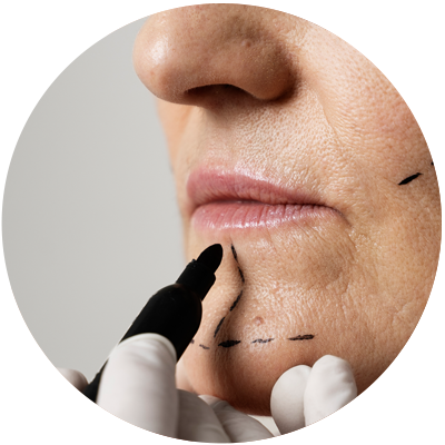 Reduced Appearance of Fine Lines
